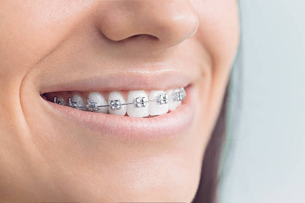 Best Tooth Extraction  in Brookfield, IL